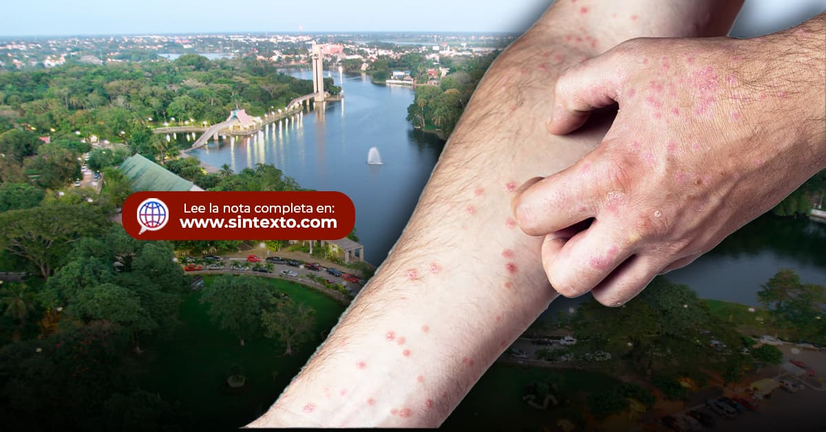 Calma pide May por Sarampión, asegura contención