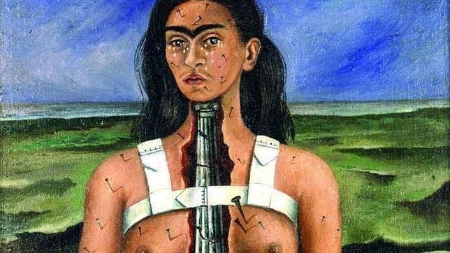 Síndrome de Cola de Caballo atormentó a Frida Kahlo