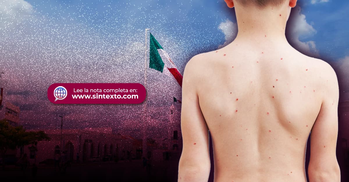 Admite Salud sarampión al alza en Tabasco