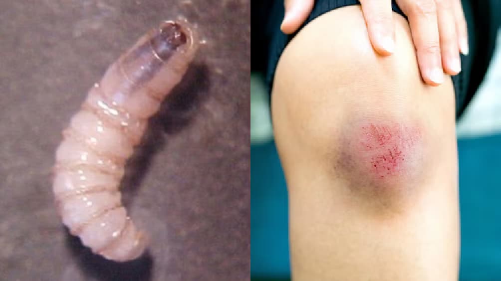 Otro tabasqueño con gusano barrenador